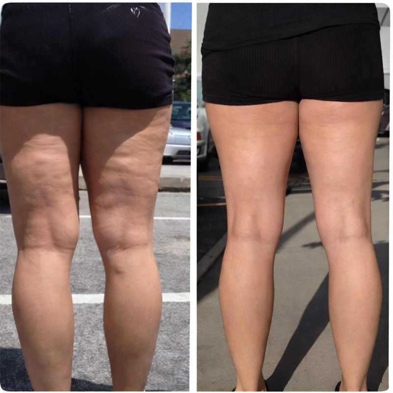 Uneven Texture Appearance